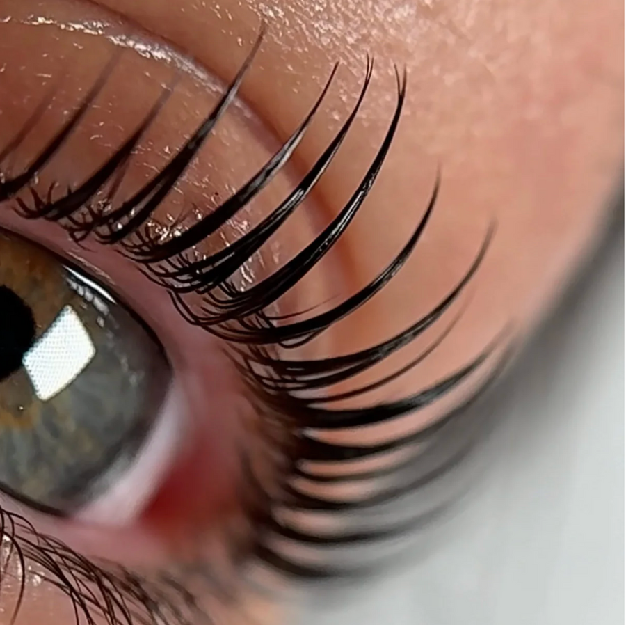 Brow result